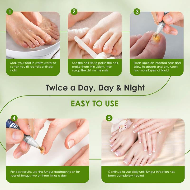 4-Pack Nail Fungus Treatment Pens – 25% Undecylenic Acid, Extra Strength Formula with Twist Pen Applicator