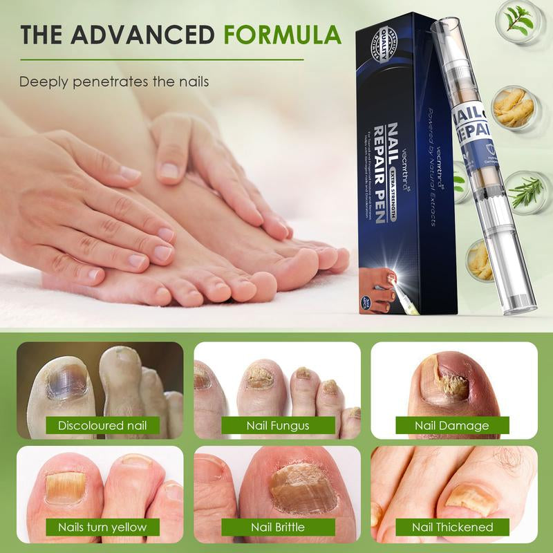 4-Pack Nail Fungus Treatment Pens – 25% Undecylenic Acid, Extra Strength Formula with Twist Pen Applicator